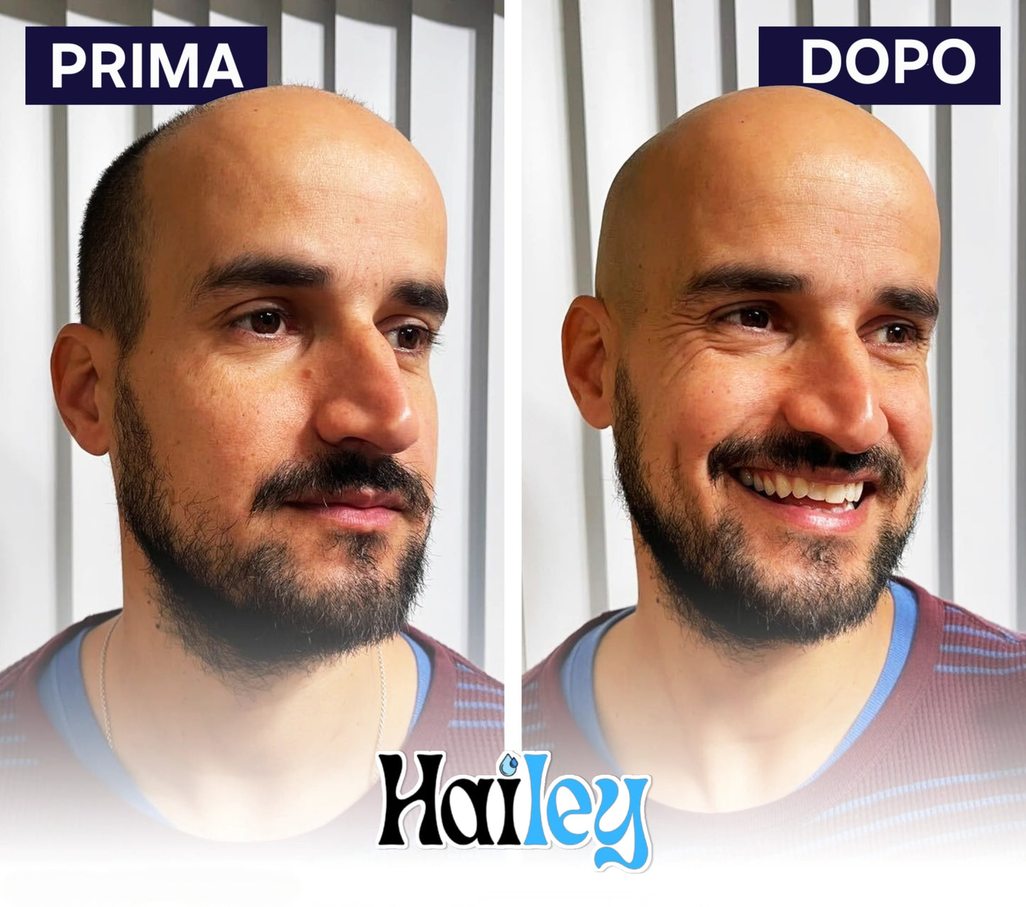 #1 Rasoio Hailey PRO per Testa, Viso, Corpo, e Area Personale
