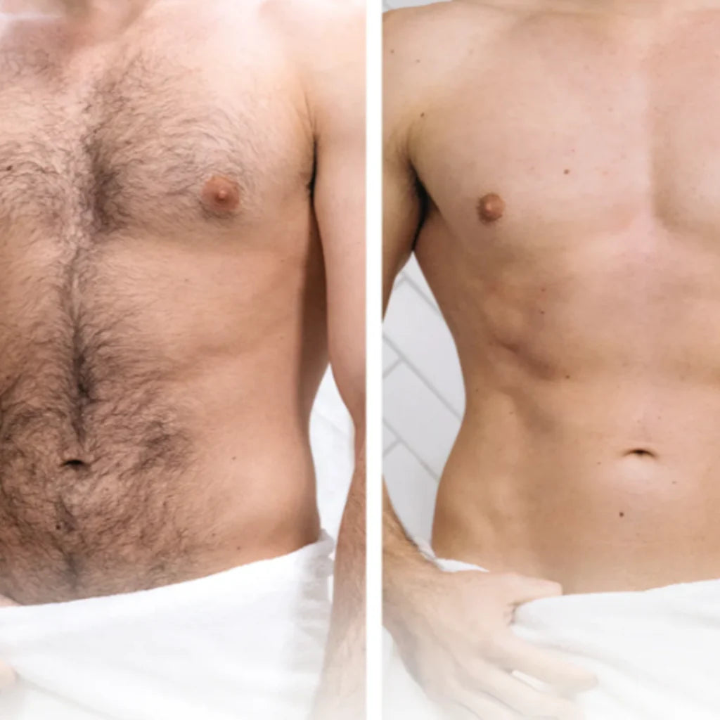 #1 Rasoio Hailey PRO per Testa, Viso, Corpo, e Area Personale